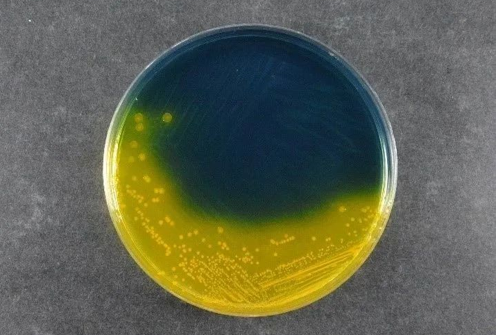 Gıda Güvenliğinin Sağlanması: Babio’nun Salmonella Shigella Agar (SS) Global Patojen Algılama Standartlarını Destekler