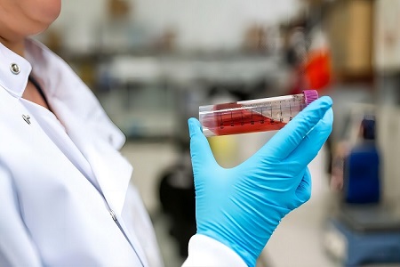 Babio’nun STGG taşıma ortamı ile solunum örneklerini koruyun