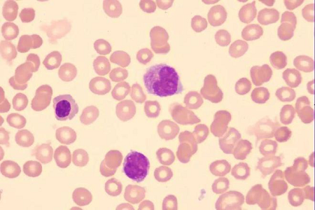 Babio, küresel laboratuvarlar için yüksek kaliteli giemsa leke çözümü başlattı