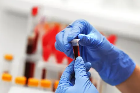 Babio, güvenilir klinik numune taşımacılığı için sıvı amies ortamını tanıtıyor